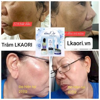 ket-qua-khach-hang-lkaori-vn-1