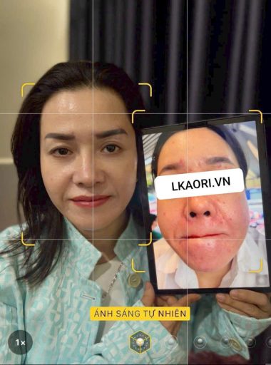ket-qua-khach-hang-lkaori-vn-2