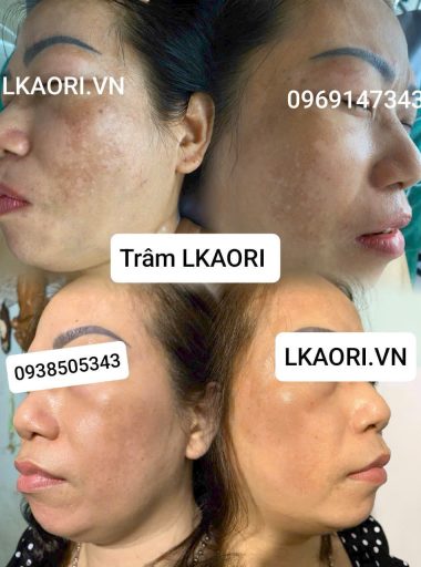 ket-qua-khach-hang-lkaori-vn-3