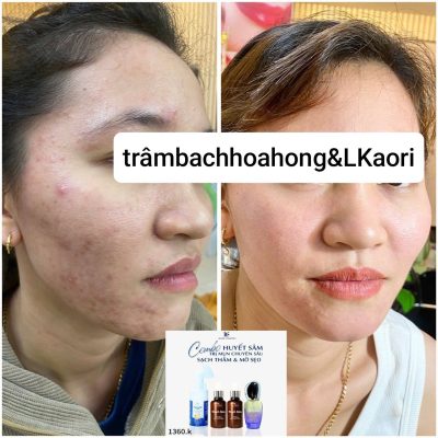 lkaori-tri-mun-2025-01-10-2