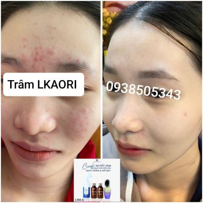 lkaori-tri-mun-2025-01-13-1