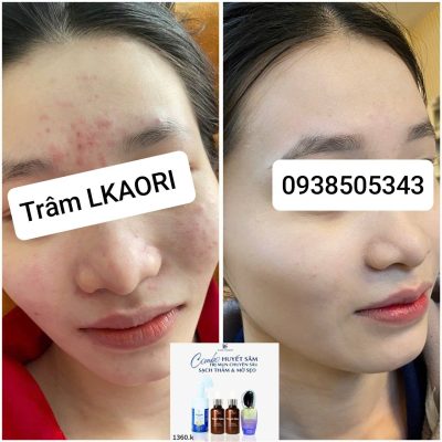 lkaori-tri-mun-2025-01-13-2