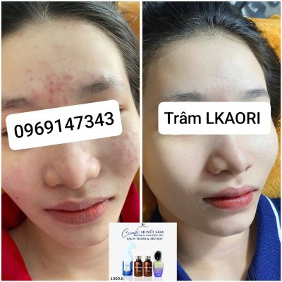 lkaori-tri-mun-2025-01-13-3