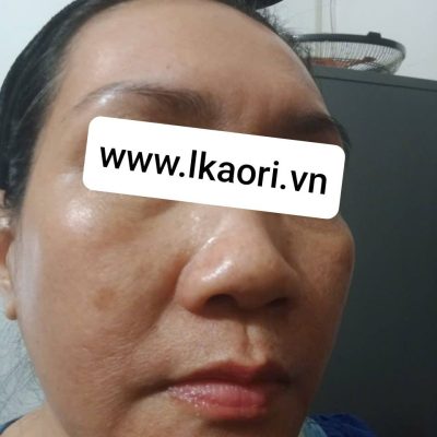 lkaori-tri-nam-2025-03-15-2