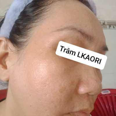 lkaori-tri-nam-2025-03-15-3